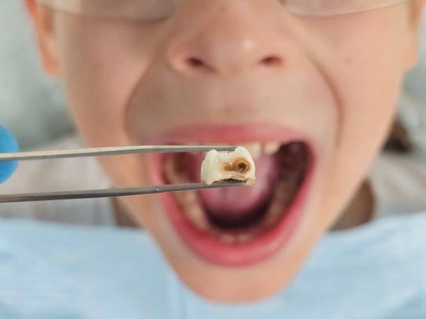 Best Emergency Dental Care for Trauma or Injury in Donalsonville, GA